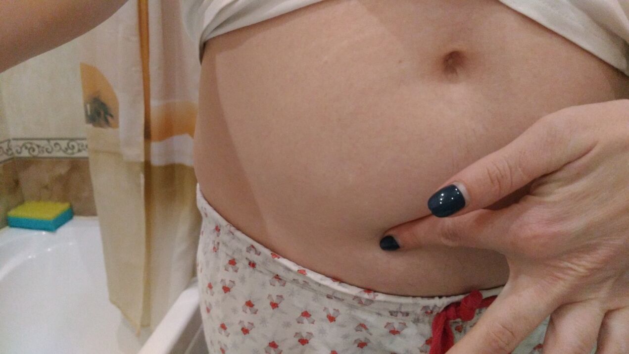 Kişisel deneyimlerden elde edilen helmint enfeksiyonu belirtileri