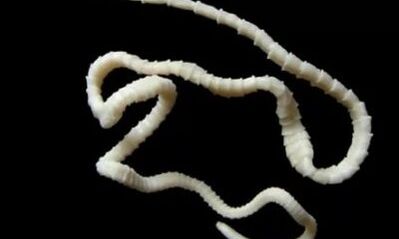 sestod paraziti vücuttan nasıl çıkarılır