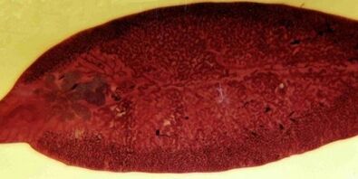 trematod paraziti vücuttan nasıl çıkarılır