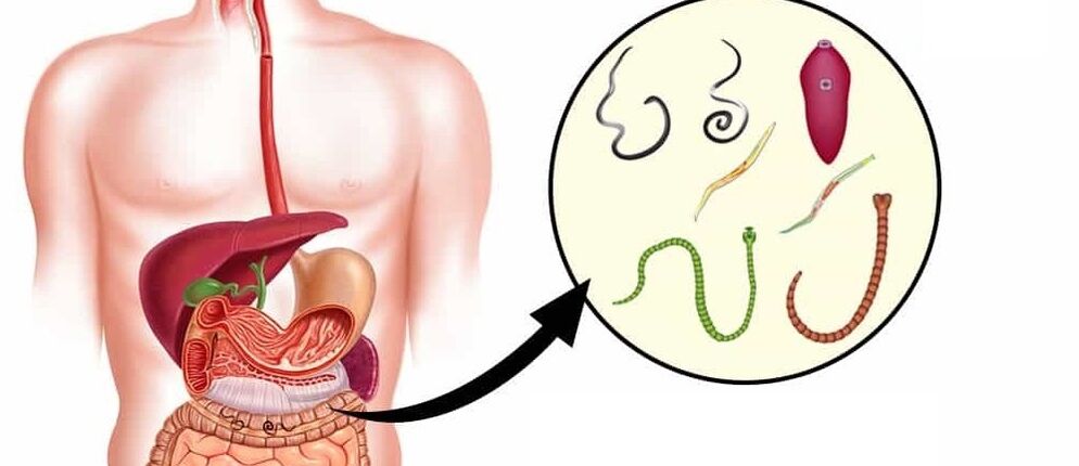 İnsan vücudundaki parazitler